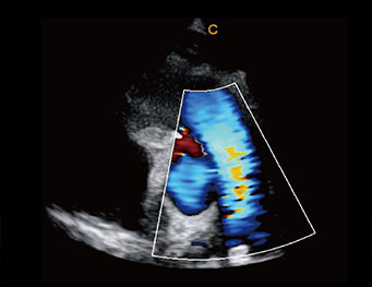 Chison QBit 9 — Ecógrafo Portátil Veterinario Inteligente miniatura 5