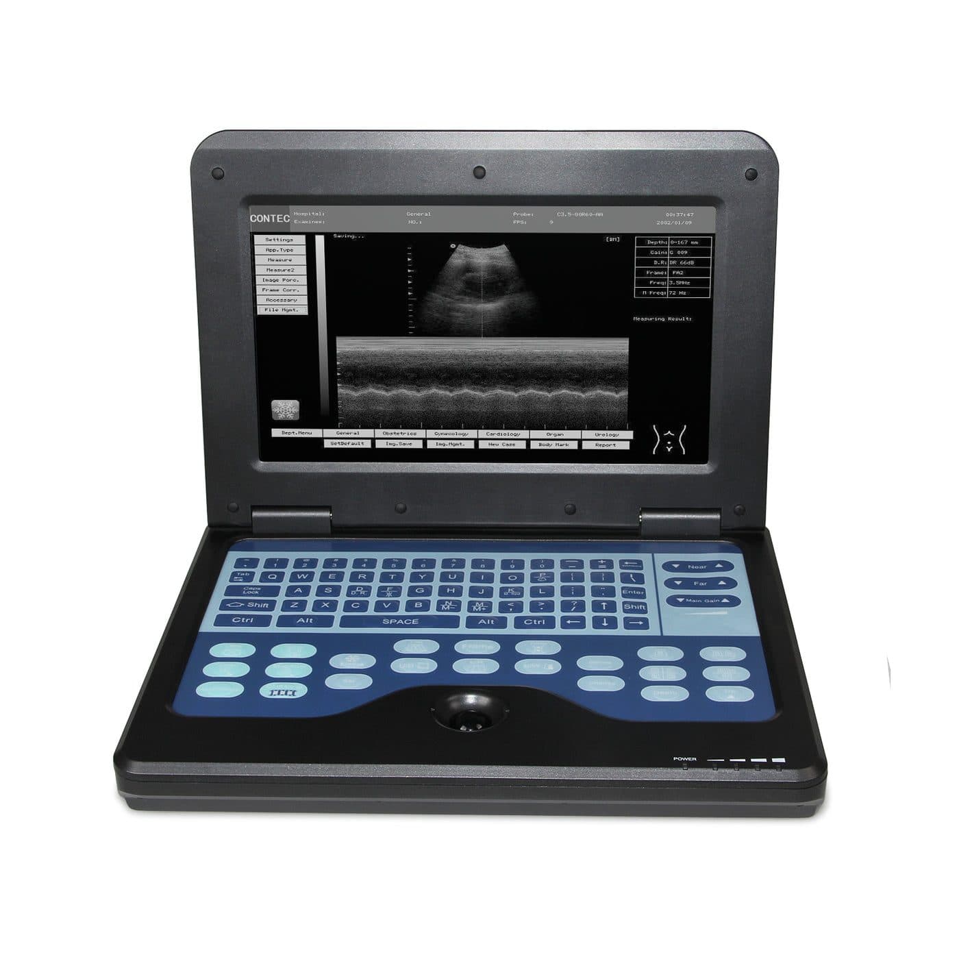 Contec CMS600P2VET — Ecógrafo Portátil Laptop para Veterinaria miniatura 2