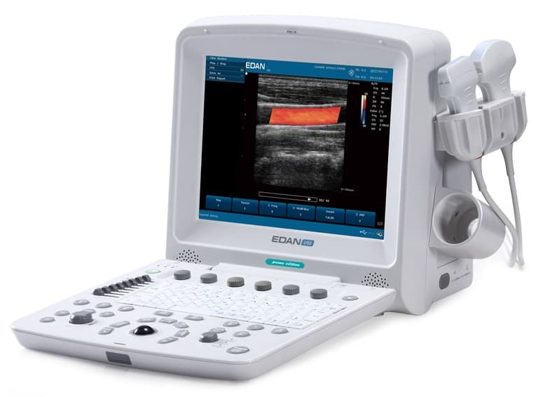 EDAN U50 Vet Prime — Ecógrafo Veterinario Portátil — foto 1