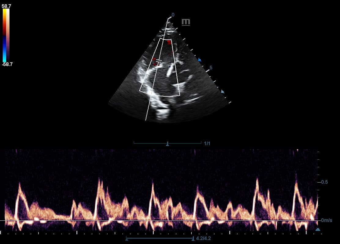 Mindray DP-50 Vet — Ecógrafo Veterinario Blanco y Negro con Doppler miniatura 2