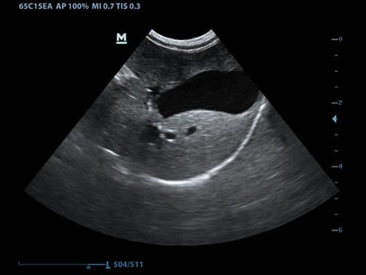 Mindray DP-50 Vet — Ecógrafo Veterinario Blanco y Negro con Doppler miniatura 3