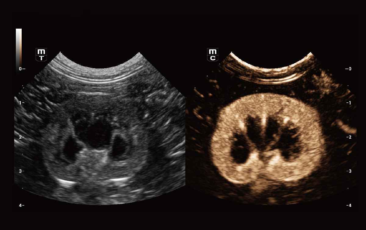 Mindray Vetus 9 — Ecógrafo Veterinario Gama Alta miniatura 3
