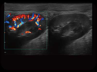 SonoScape X5V — Ecógrafo Portátil Veterinario Color Doppler miniatura 3