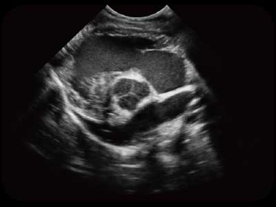 SonoScape X5V — Ecógrafo Portátil Veterinario Color Doppler miniatura 4