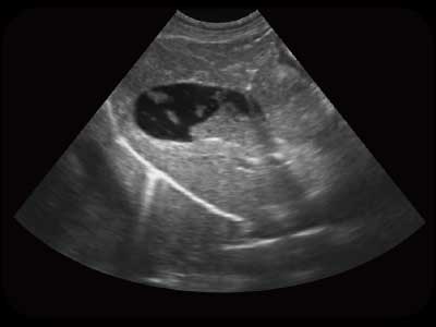 SonoScape X5V — Ecógrafo Portátil Veterinario Color Doppler miniatura 5