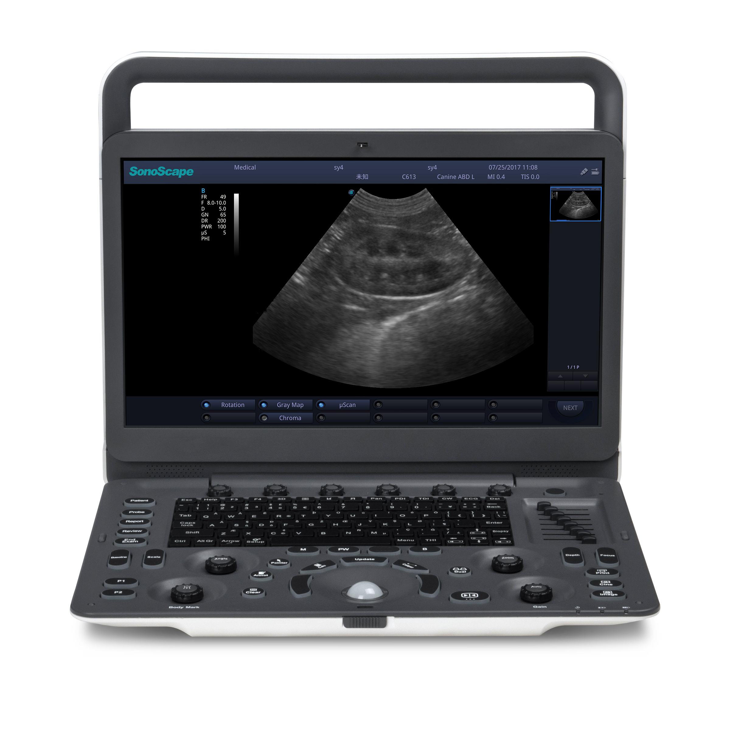 SonoScape E1V — Ecógrafo Portátil Veterinario B/N